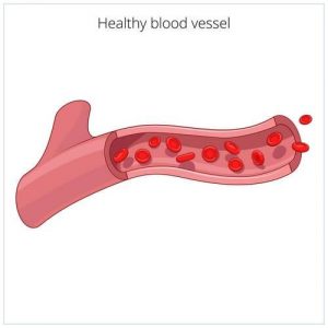 Эмболизация маточных артерий: суть процедуры