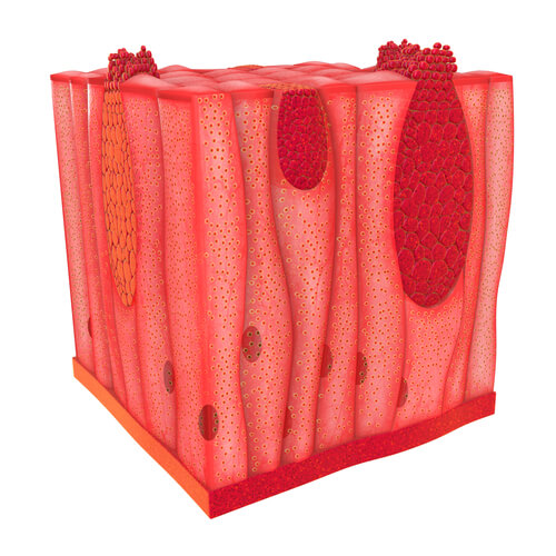 Лечение саркомы Капоши в Израиле