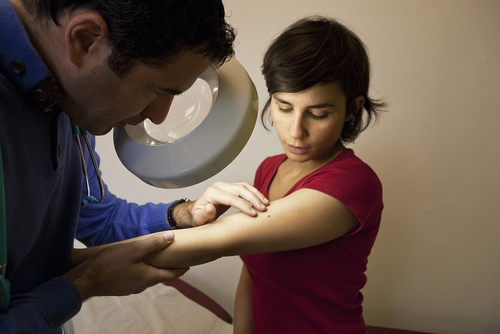 Лечение плоскоклеточного рака кожи в Израиле